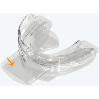 Myotalea® Tongue, Lip & Jaw Appliance for Braces - TLJB